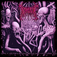 Diabetic Ketoacidosis - Laparoscopic Treatment Of Echinococcosis Of The Spleen загрузить