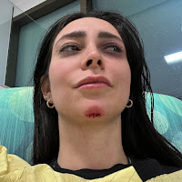 Lølø - Faceplant загрузить